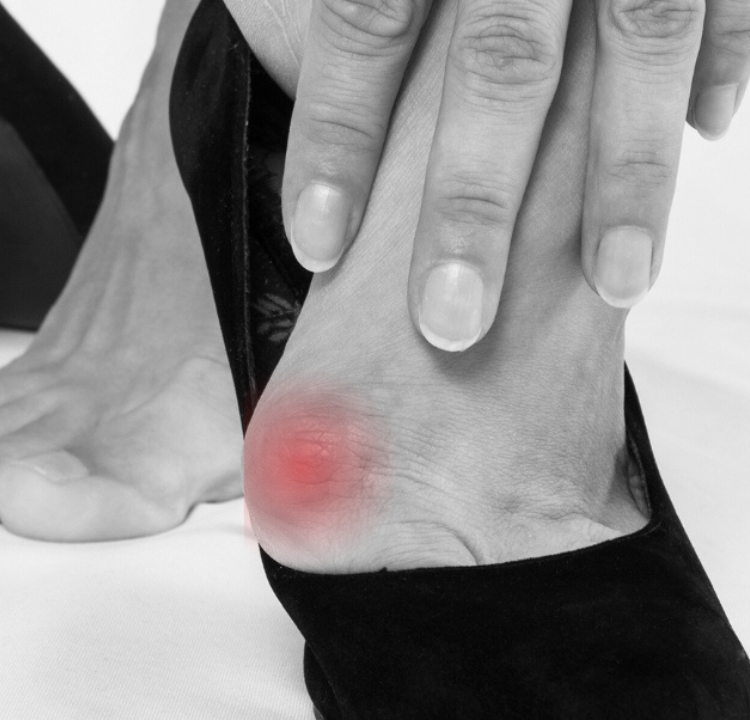 Behandla och förebygg Hallux Valgus med ortopediska skor och inlägg | Stinaa.J Officiell Butik