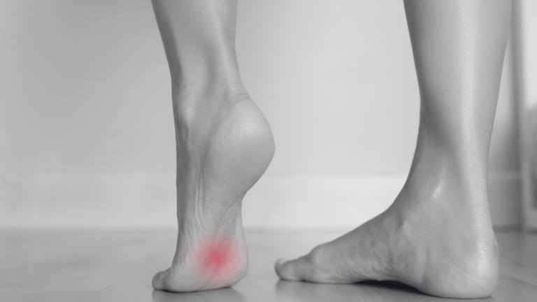 Arch Injuries Fallen Metatarsal Arch | Stinaa.J Official Store